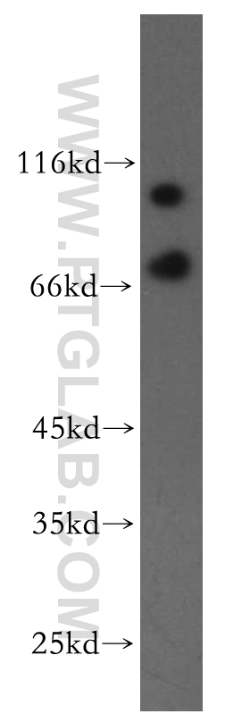 WB analysis of HeLa using 13723-1-AP