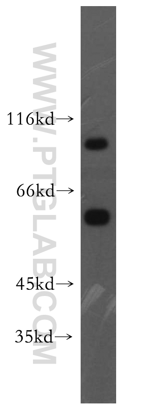 VPS34