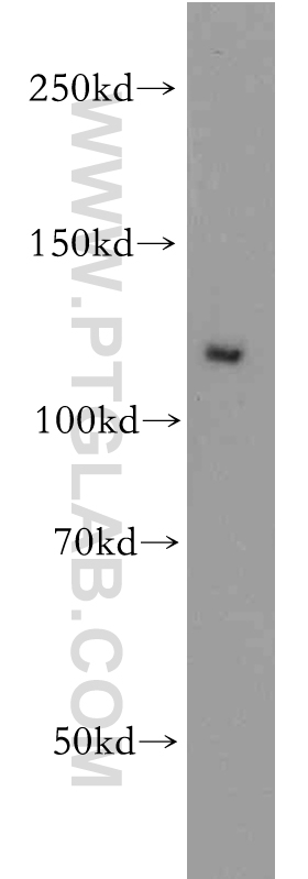 PI3 Kinase p110 Alpha Polyclonal antibody