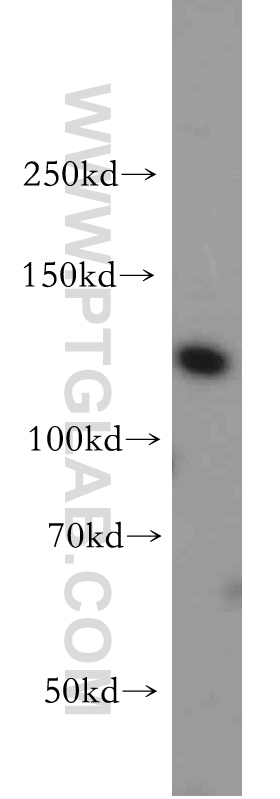 WB analysis of HepG2 using 20583-1-AP