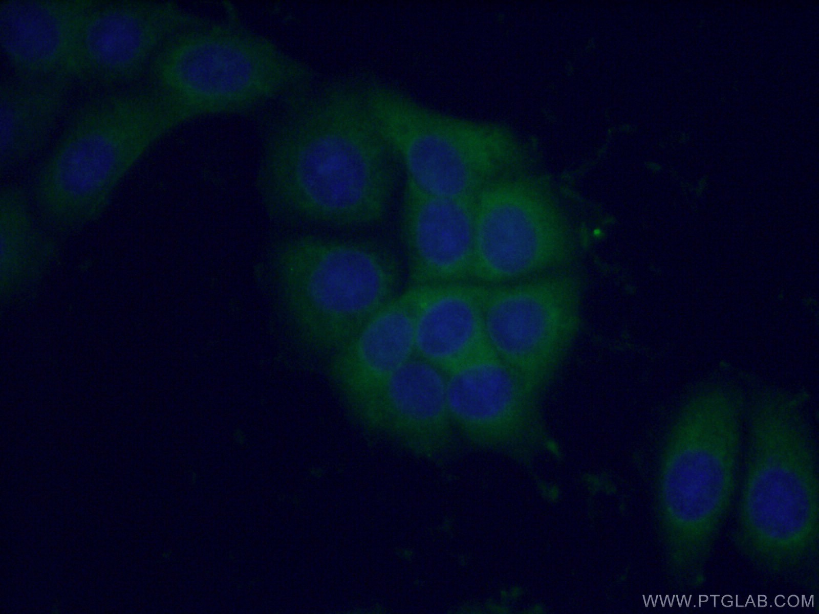 IF Staining of MCF-7 using 21890-1-AP