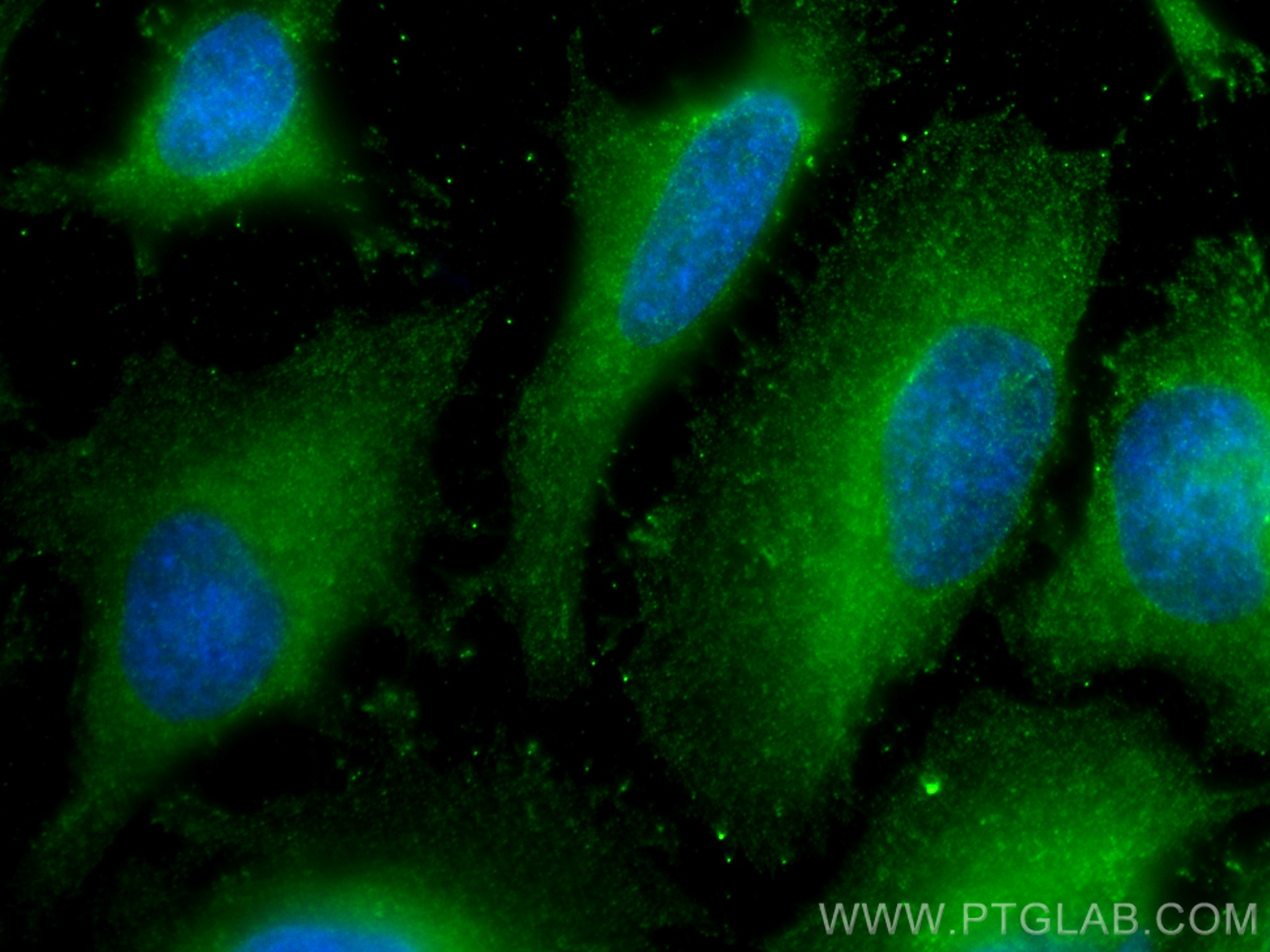 IF Staining of HeLa using 67071-1-Ig