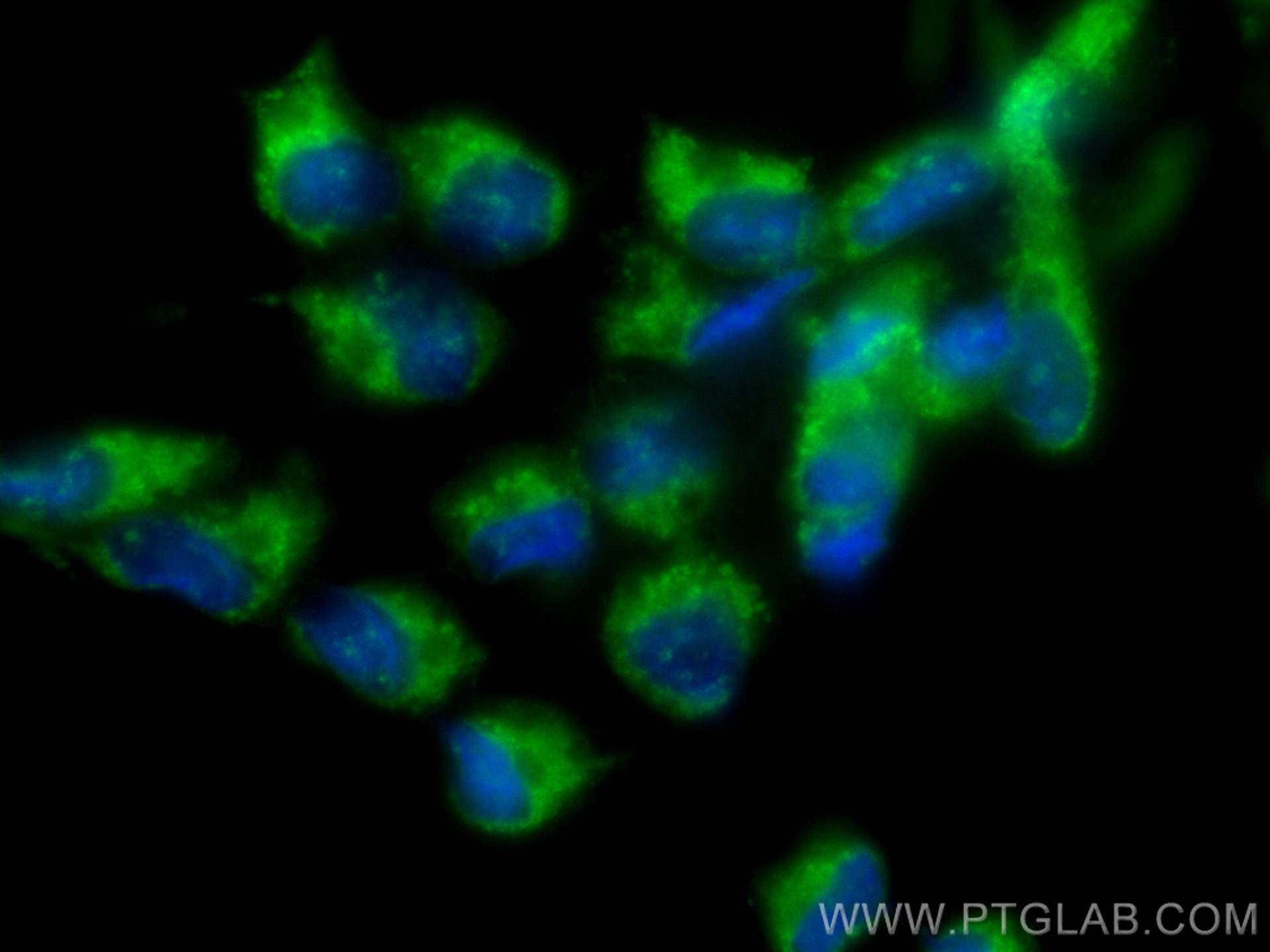 IF Staining of LNCaP using CL488-67964