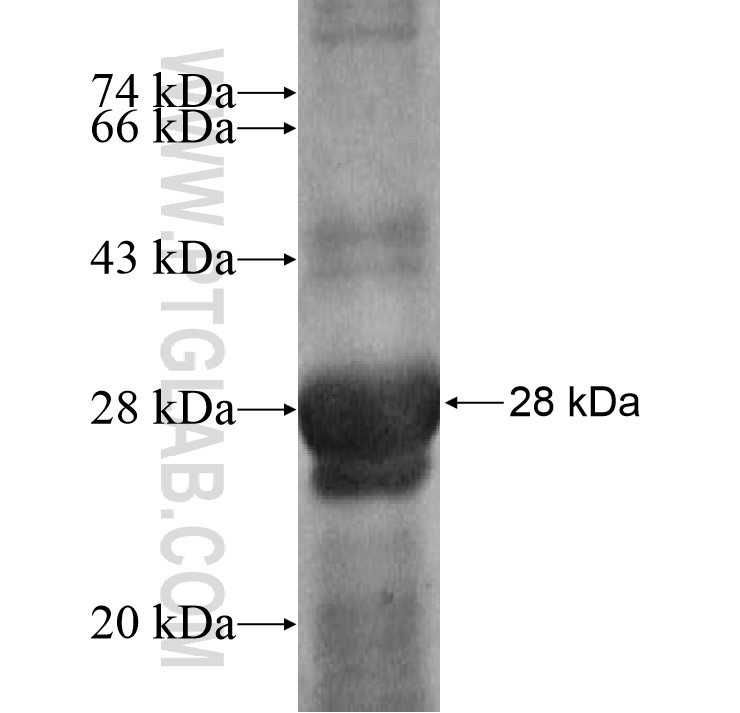 PIK3CD fusion protein Ag16713 SDS-PAGE PIK3CD fusion protein Ag16713 SDS-PAGE