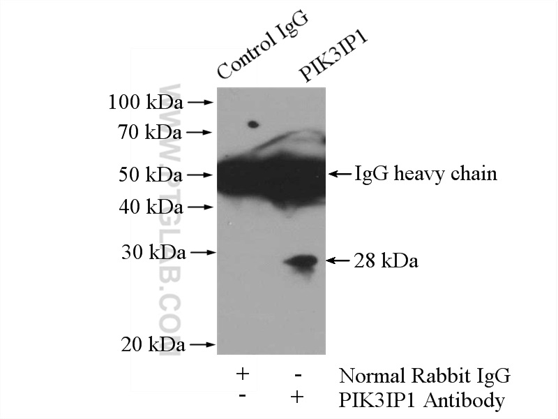 IP experiment of HeLa using 16826-1-AP