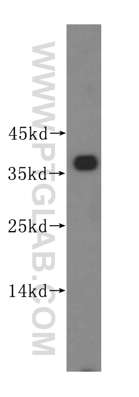 WB analysis of HeLa using 16826-1-AP