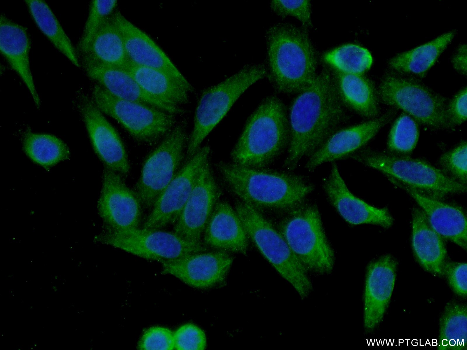 PI3 Kinase p85 Alpha