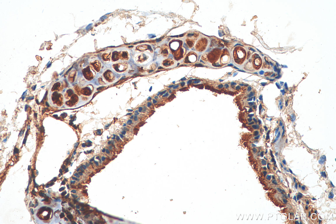 IHC staining of mouse lung using 60225-1-Ig