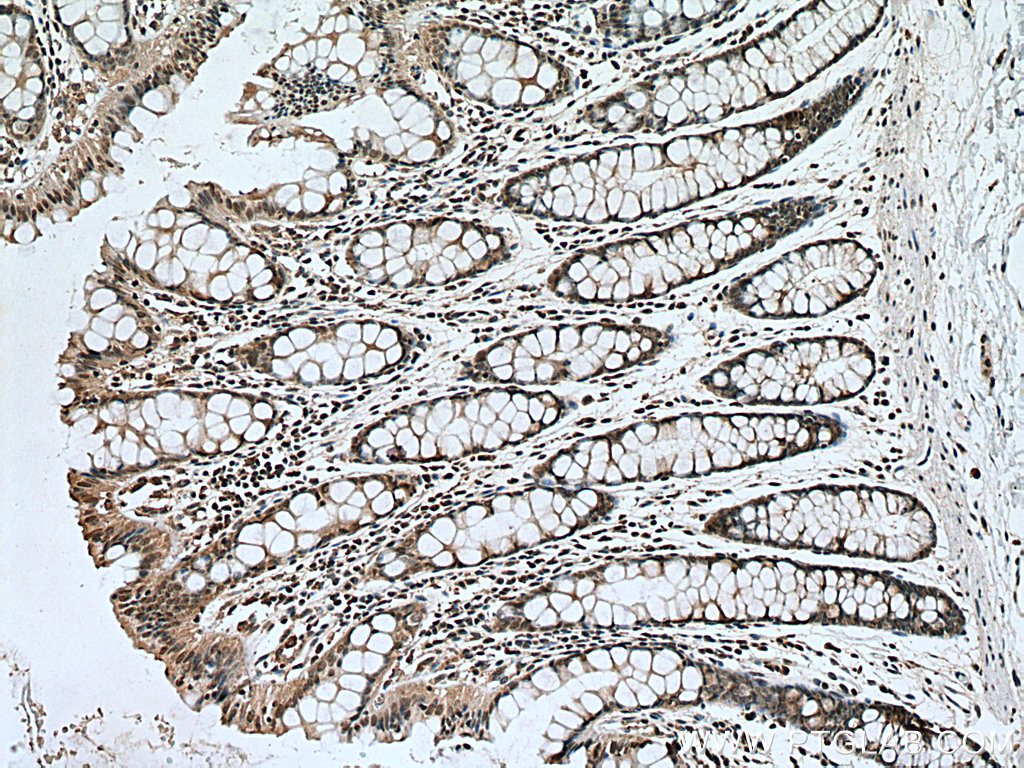 PI3 Kinase p85 Beta