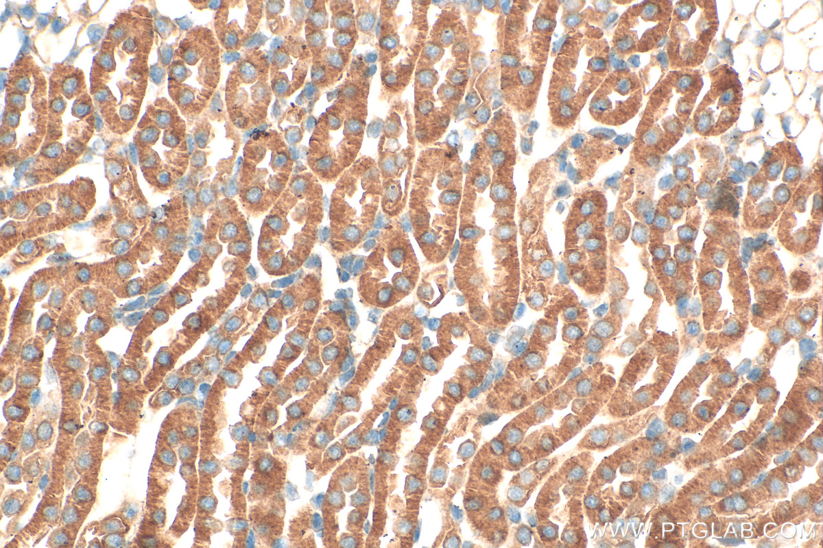 IHC staining of mouse kidney using 27035-1-AP