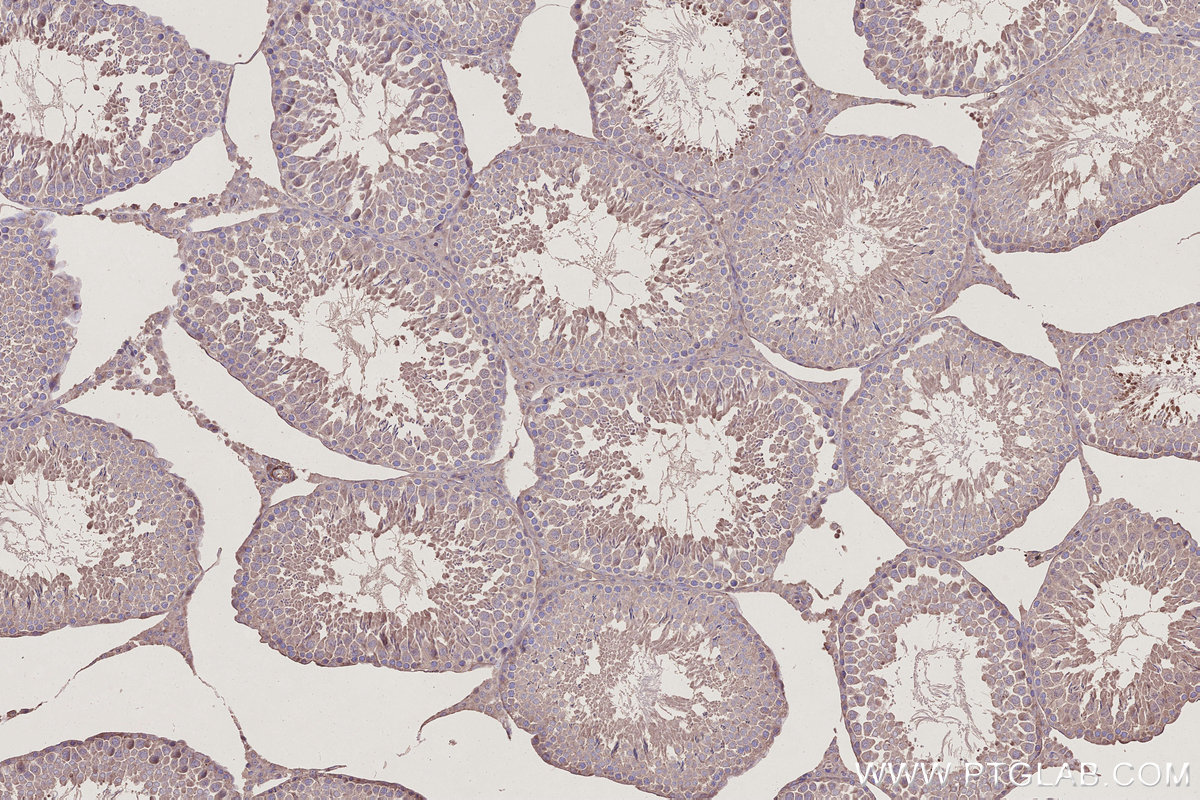 IHC staining of rat testis using 27035-1-AP IHC staining of rat testis using 27035-1-AP