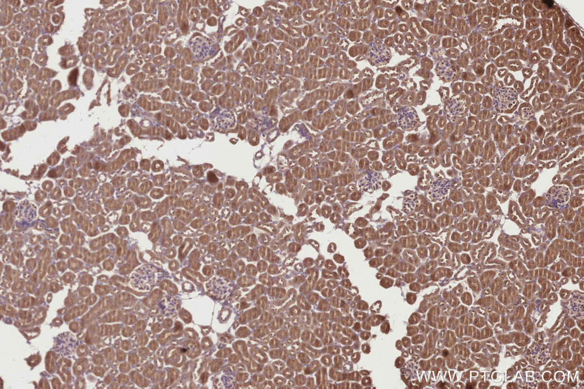 IHC staining of mouse kidney using 17894-1-AP IHC staining of mouse kidney using 17894-1-AP