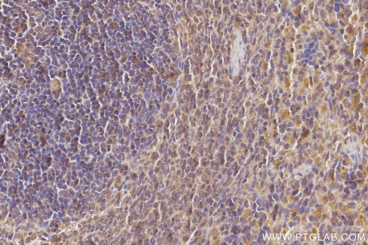 IHC staining of rat spleen using 17894-1-AP IHC staining of rat spleen using 17894-1-AP