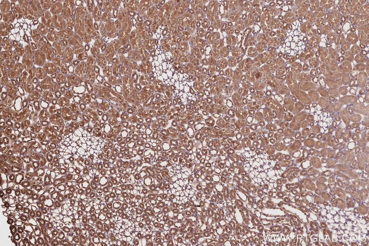 IHC staining of rat kidney using 17894-1-AP IHC staining of rat kidney using 17894-1-AP