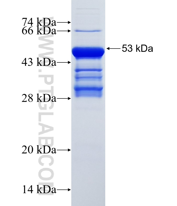 PILRA fusion protein Ag2385 SDS-PAGE