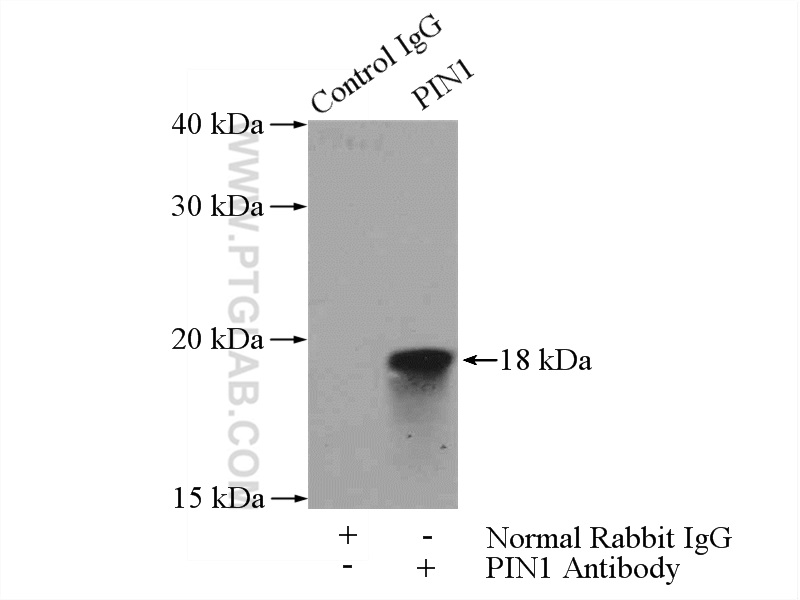 IP experiment of HepG2 using 10495-1-AP