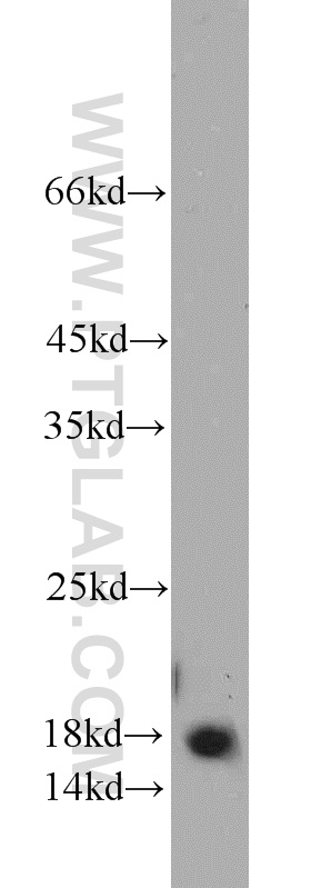 PIN1 Polyclonal antibody