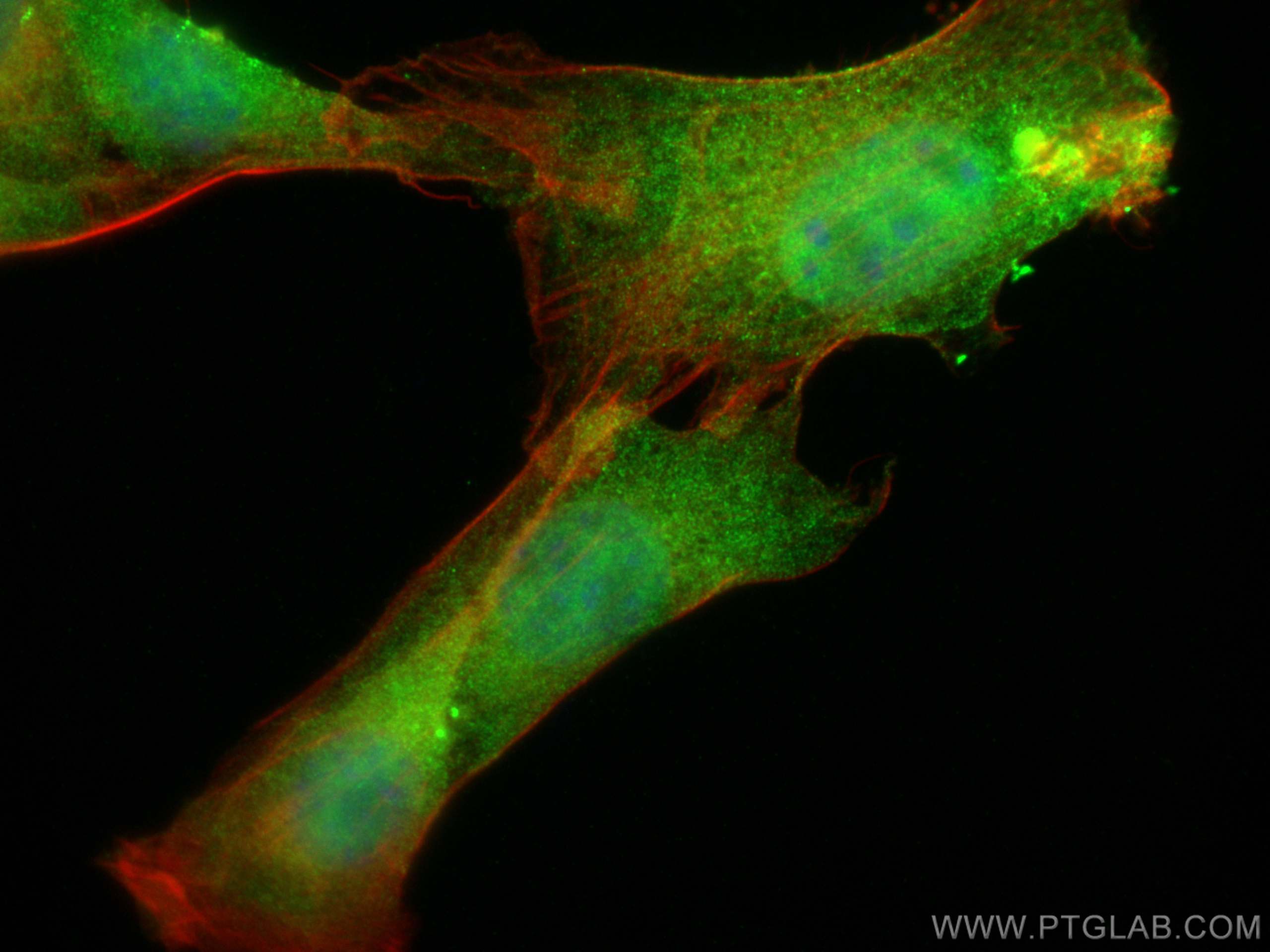 IF Staining of NIH/3T3 using 68127-1-Ig (same clone as 68127-1-PBS)