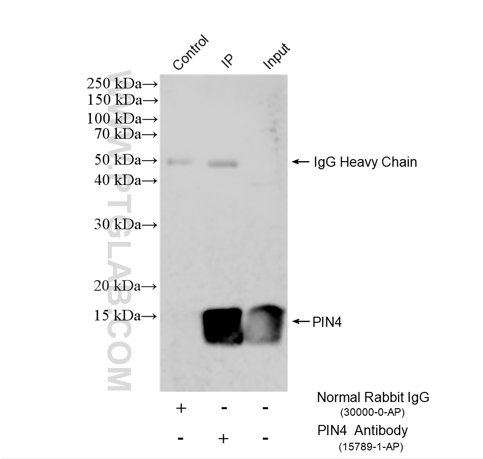 IP experiment of HEK-293 using 15789-1-AP