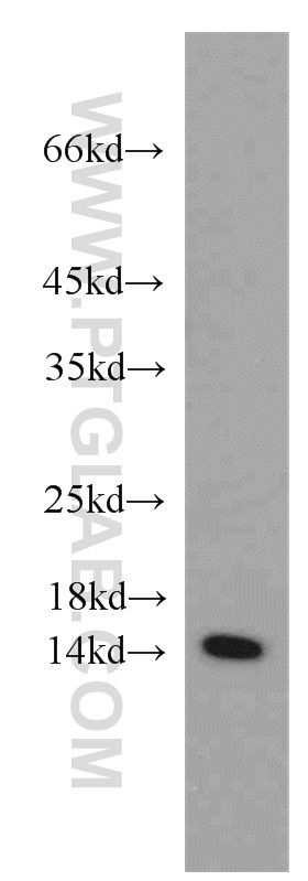 WB analysis of mouse liver using 15789-1-AP