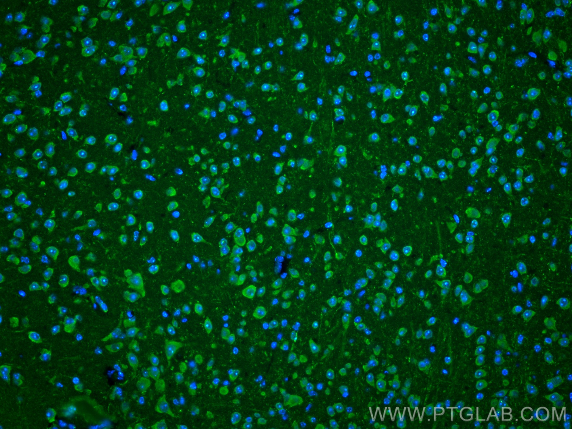 IF Staining of mouse brain using 23274-1-AP