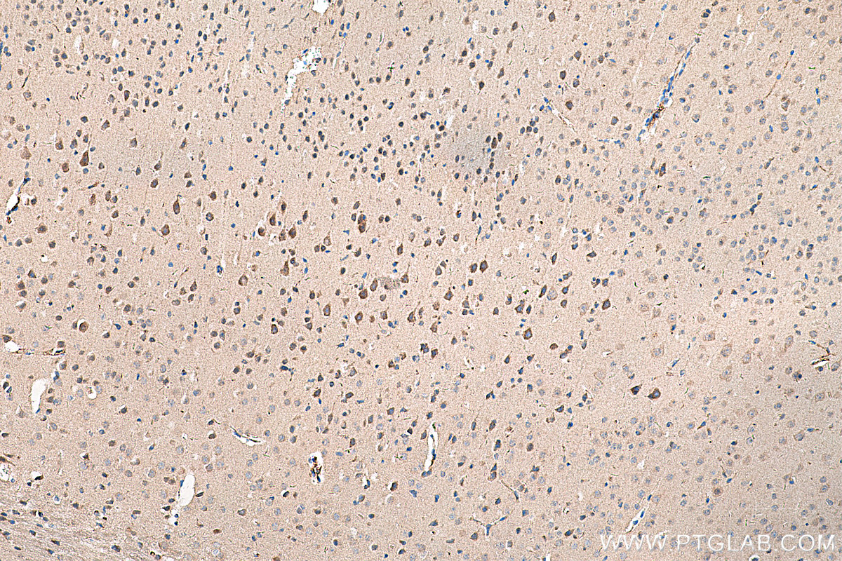 IHC staining of mouse brain using 23274-1-AP