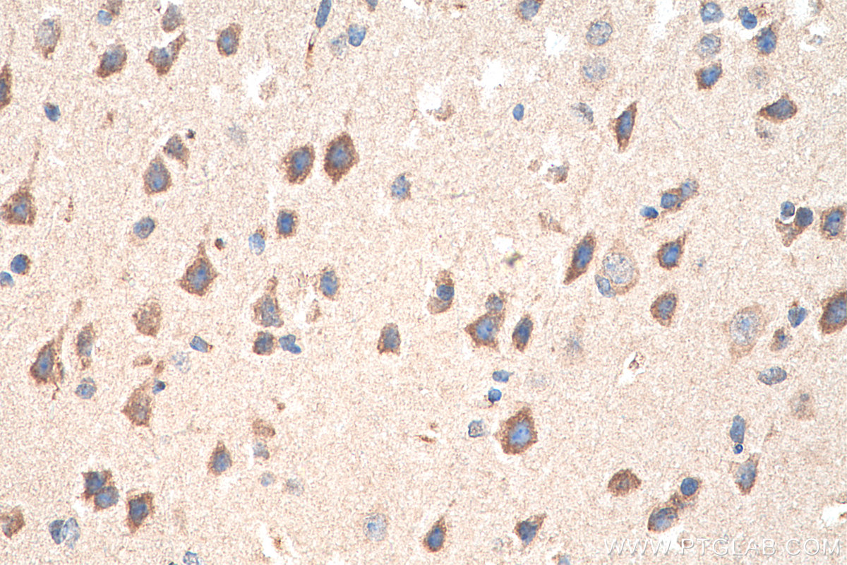 IHC staining of mouse brain using 23274-1-AP