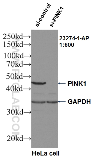 WB analysis of HeLa using 23274-1-AP