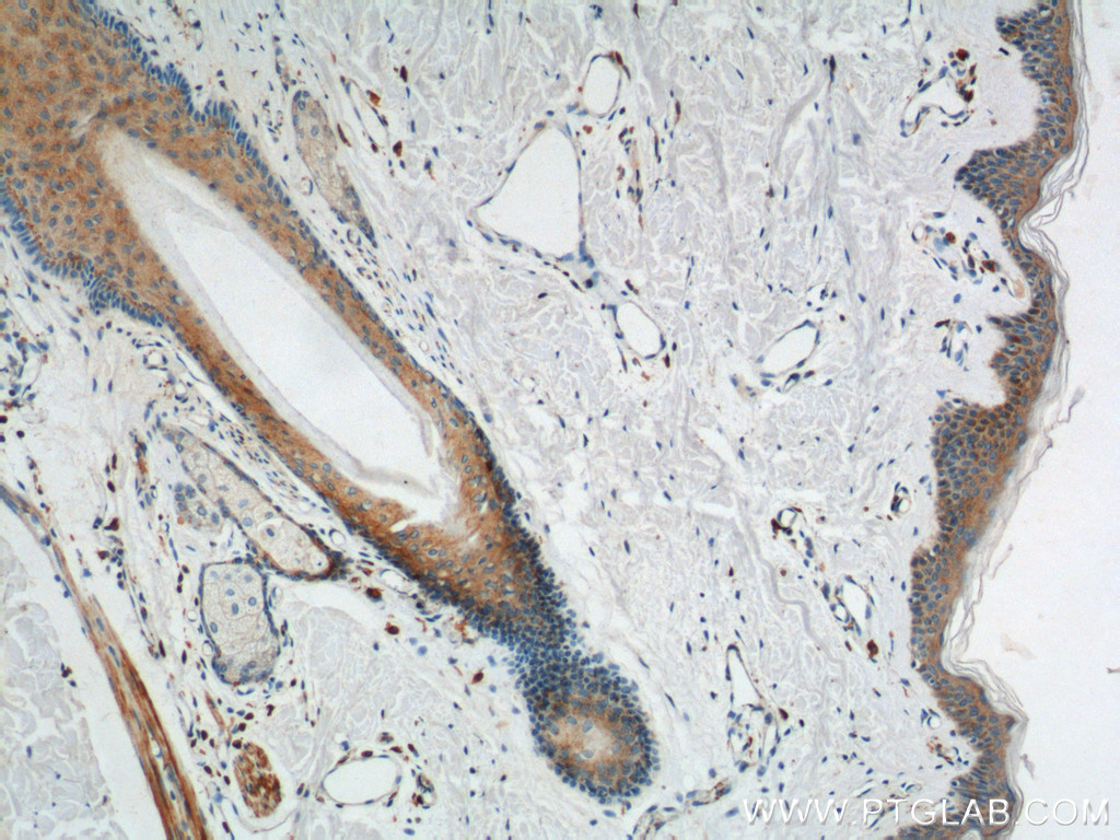 IHC staining of human skin using 60210-1-Ig IHC staining of human skin using 60210-1-Ig