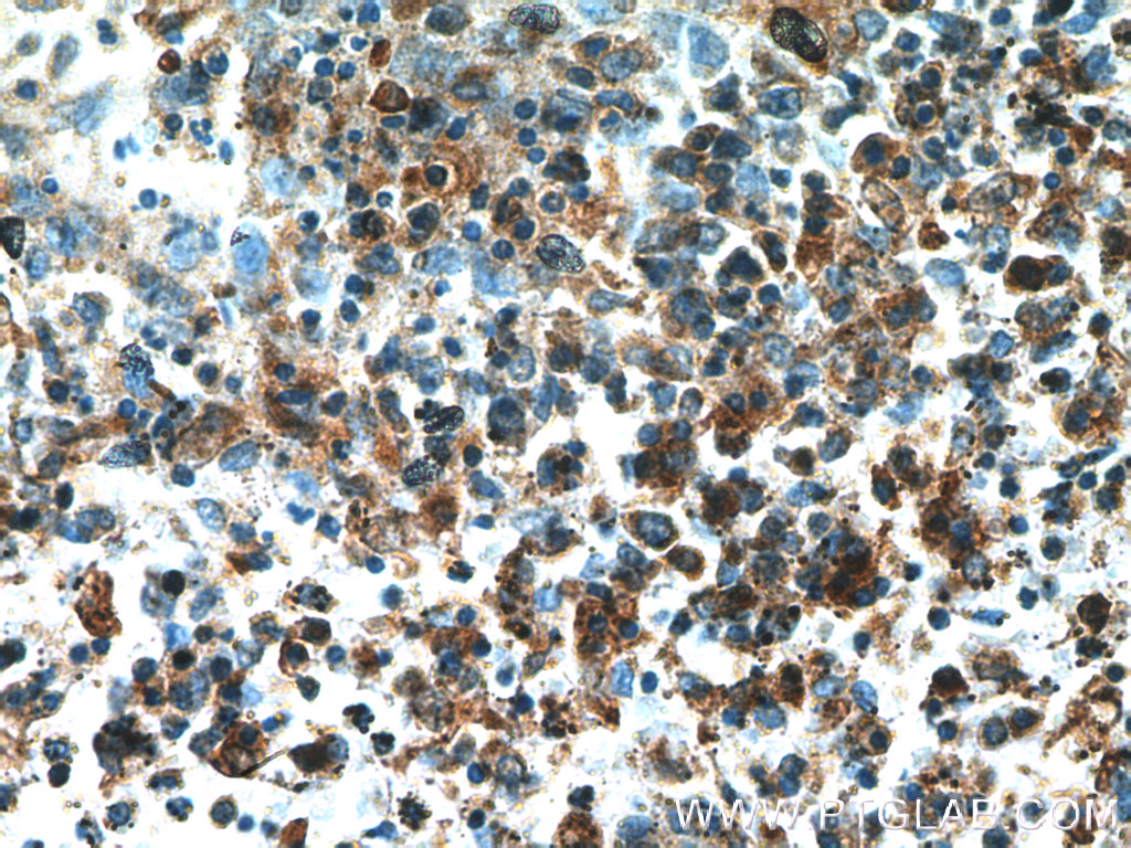 IHC staining of human spleen using 12469-1-AP