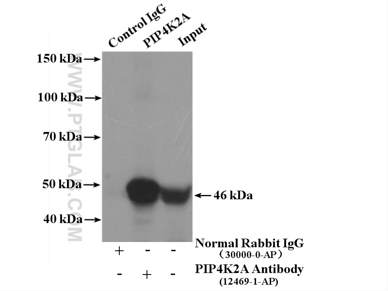 IP experiment of mouse brain using 12469-1-AP