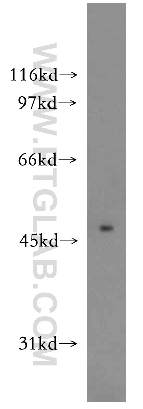 WB analysis of mouse brain using 12469-1-AP