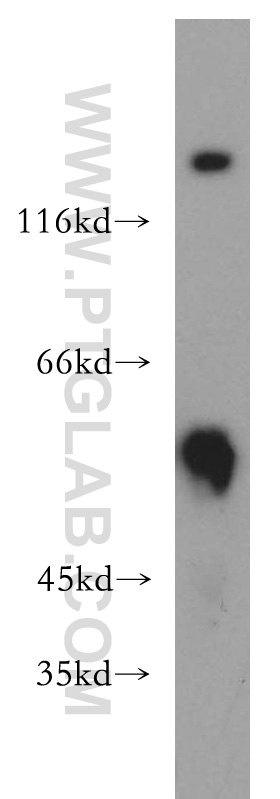 WB analysis of HeLa using 13218-1-AP