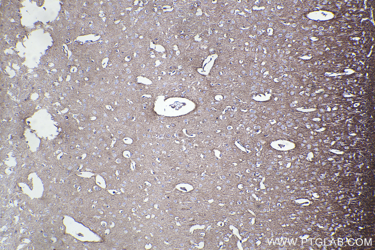 IHC staining of mouse brain using 83647-3-RR