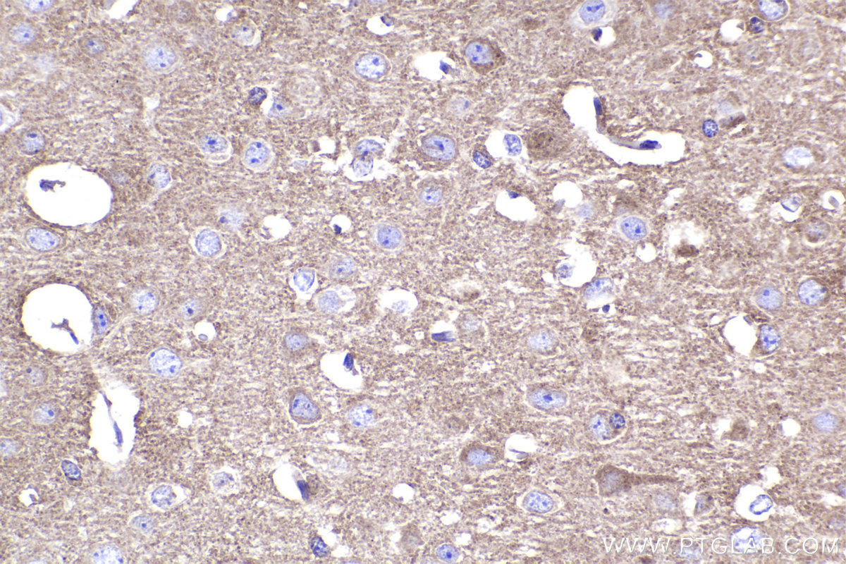 IHC staining of mouse brain using 83647-3-RR