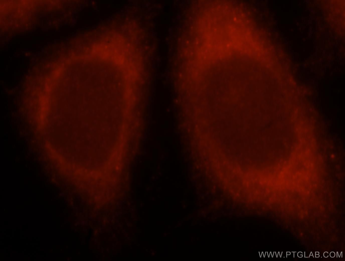 IF Staining of HeLa using 15713-1-AP