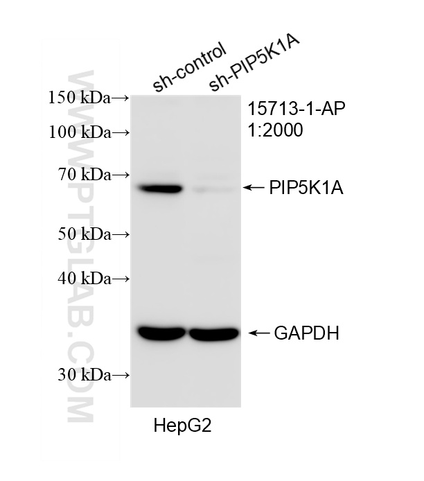 WB result of PIP5K1A antibody (15713-1-AP; 1:2000; incubated at room temperature for 1.5 hours) with sh-Control and sh-PIP5K1A transfected HepG2 cells. WB analysis of HepG2 using 15713-1-AP