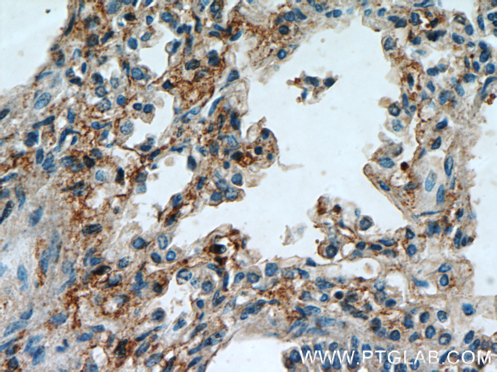 IHC staining of human lung using 12541-1-AP