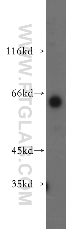 WB analysis of human testis using 12541-1-AP