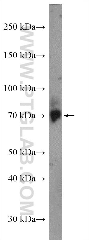 WB analysis of A549 using 27640-1-AP