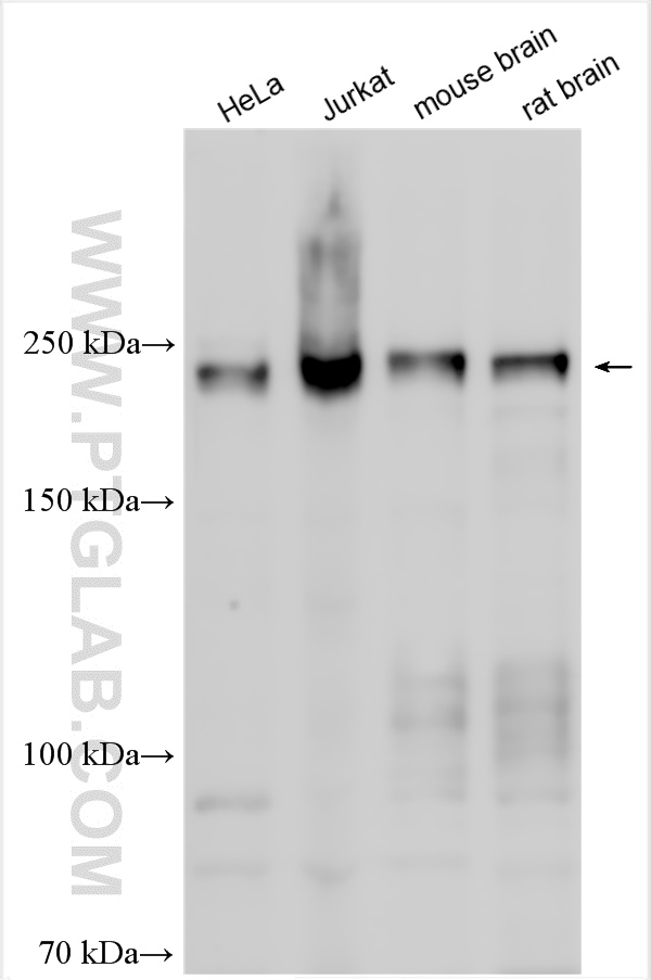 WB analysis using 13361-1-AP