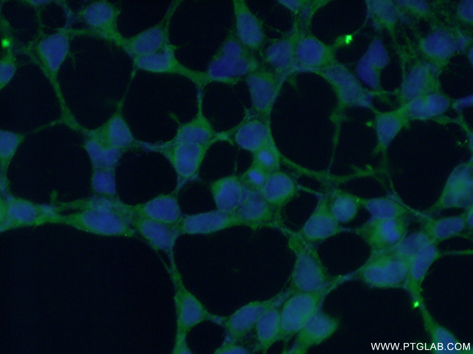 IF Staining of HEK-293 using 17547-1-AP