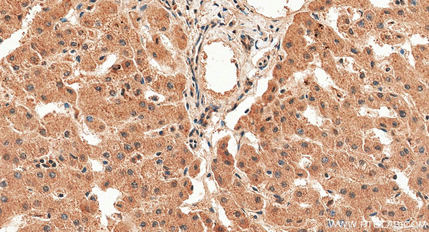 IHC staining of human liver using 10263-1-AP IHC staining of human liver using 10263-1-AP