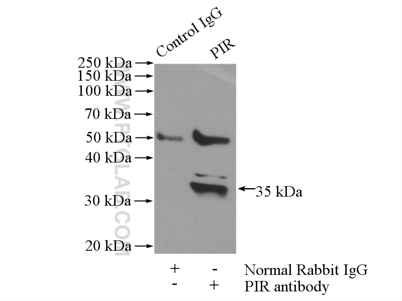 IP experiment of HeLa using 10263-1-AP