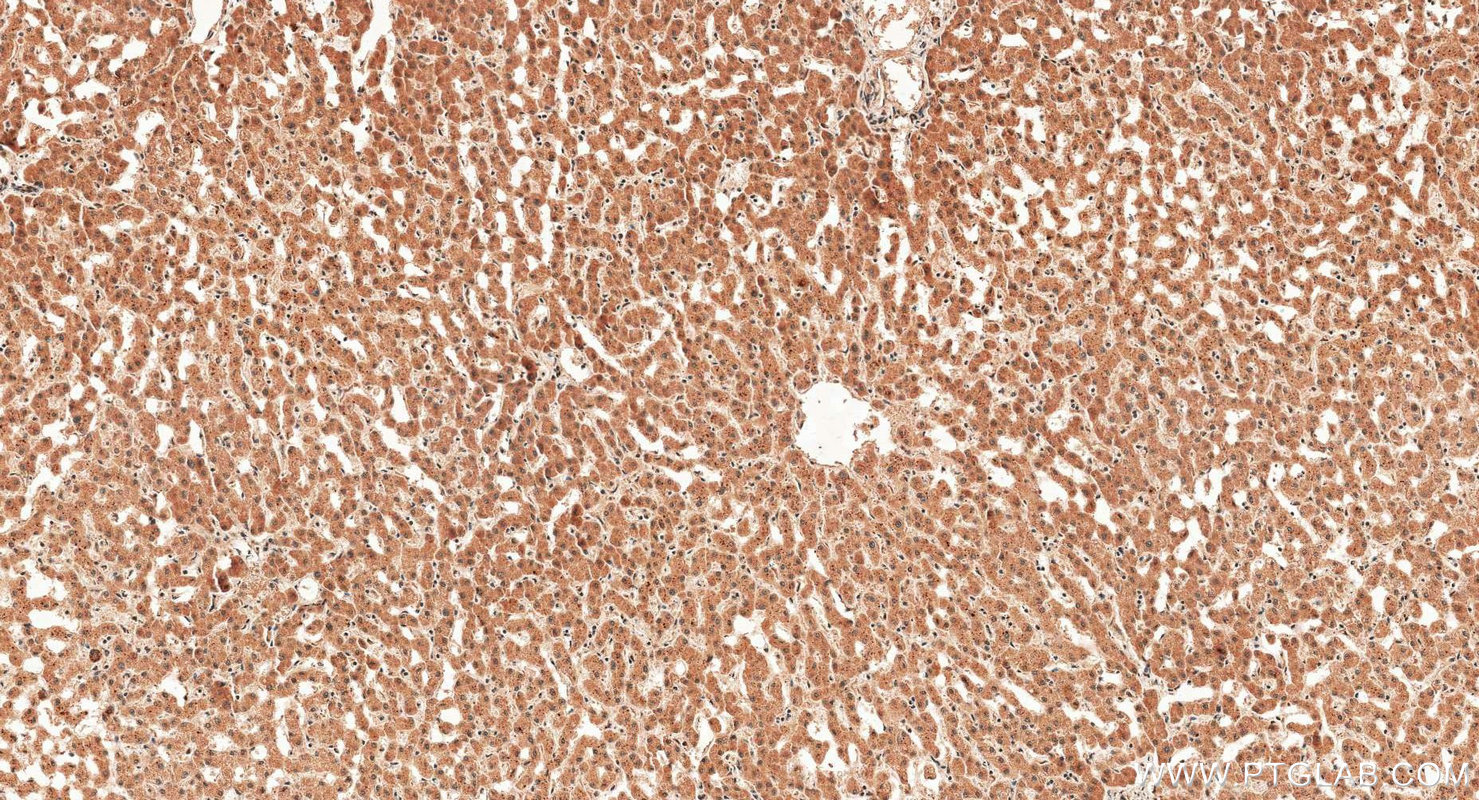 IHC staining of human liver using 67516-1-Ig