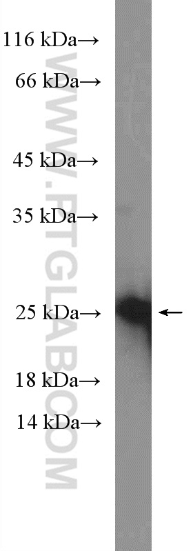 WB analysis of SH-SY5Y using 20990-1-AP