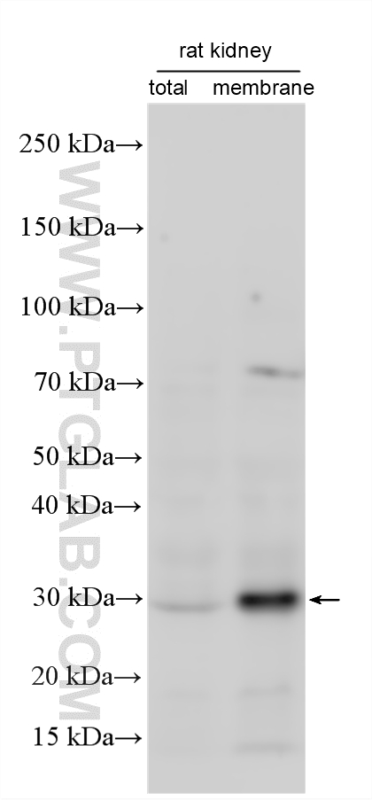 Various lysates were subjected to SDS PAGE followed by western blot with 20990-1-AP (PIRT antibody) at dilution of 1:500 incubated at room temperature for 1.5 hours. WB analysis using 20990-1-AP