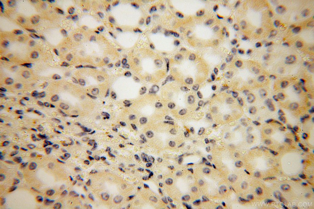 IHC staining of human kidney using 16401-1-AP