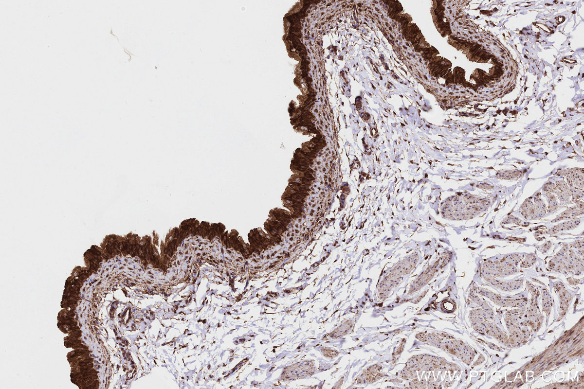 IHC staining of rat bladder using 13110-1-AP