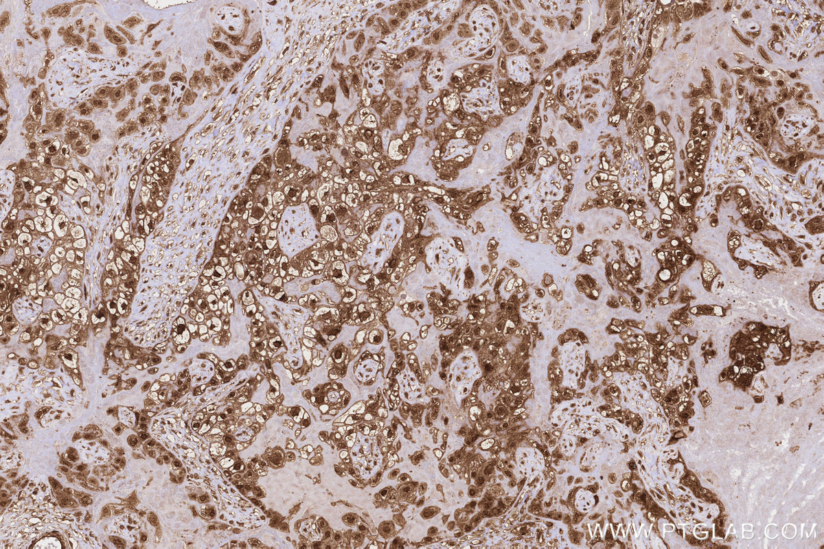 IHC staining of human placenta using 13110-1-AP